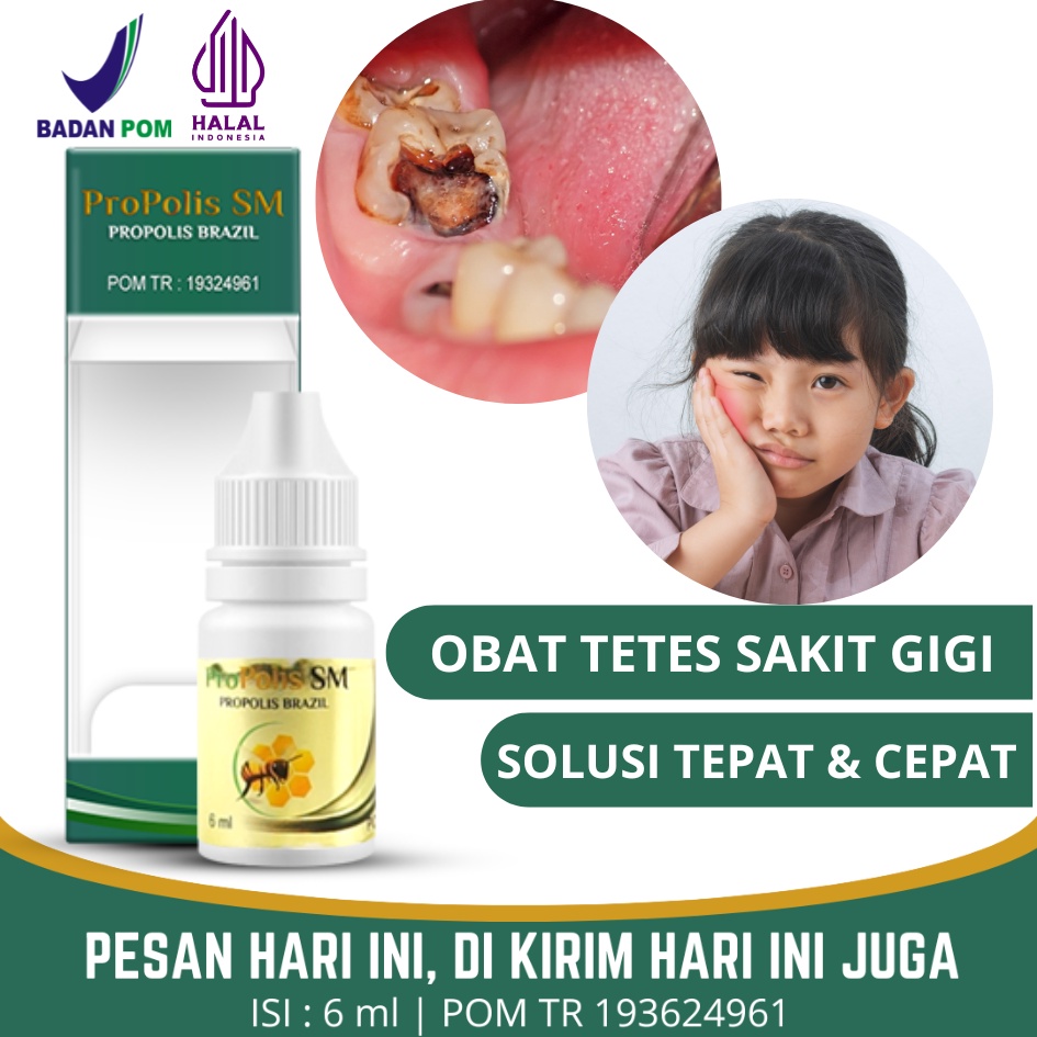 Obat Tetes Sakit Gigi Berlubang Anak, Sakit Gigi, Nyeri Gigi Anak, Obat Herbal Sakit Gigi Anak dan D