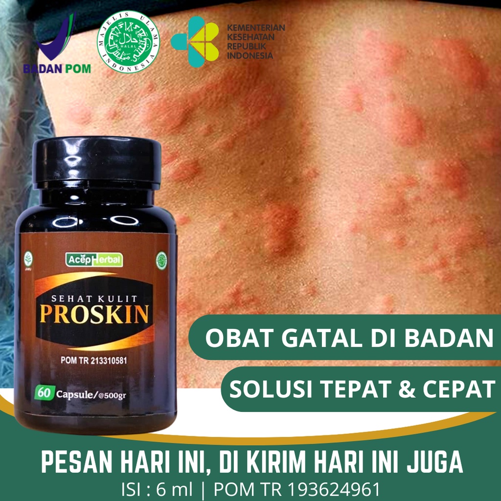 PROSKIN Obat Kulit Gatal Seluruh Badan Kaligata Proskin Kapsul Ekstrak Binahong Original Isi 60 Kaps
