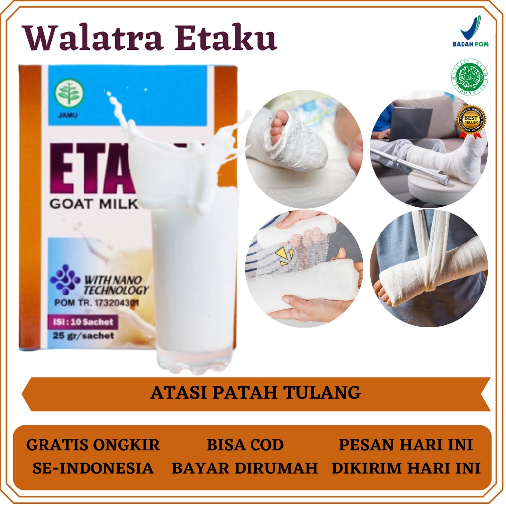 Walatra Etaku, Obat Patah Tulang, Obat Patah Tulang Anak dan Dewasa, Obat Patah Tulang Tangan, Obat 