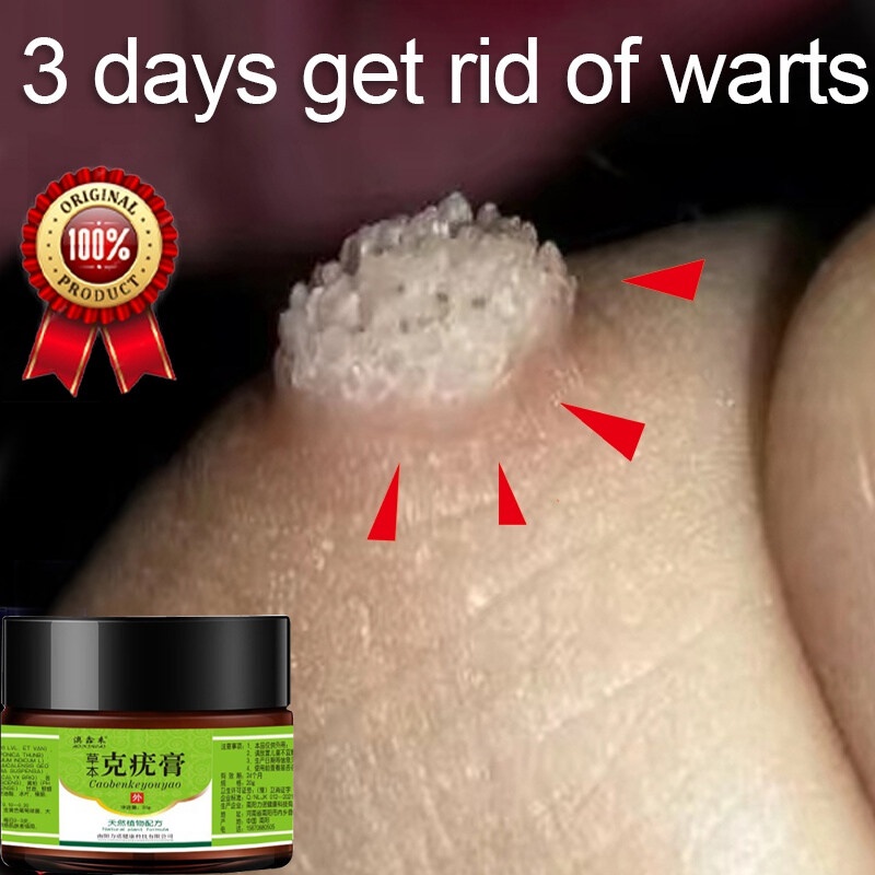 Obat Mata Ikan Penghilang Tahi Lalat Wart Removal 20g Repair And Clean Skin Tag Remover Di Wajah Menghilangkan pada mata/ wajah/ leher/ bagian tubuh/ Kapalan Di Tangan Dan Kaki Krim Antibakteri Krim Penghilang Kutil