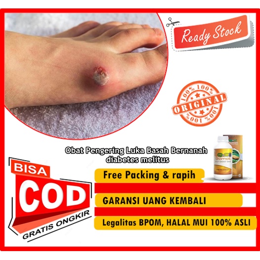 QnC Jelly Gamat - 300 Ml  - Obat Pengering Luka Basah Bernanah, diabetes melitus, obat gatal gatal l