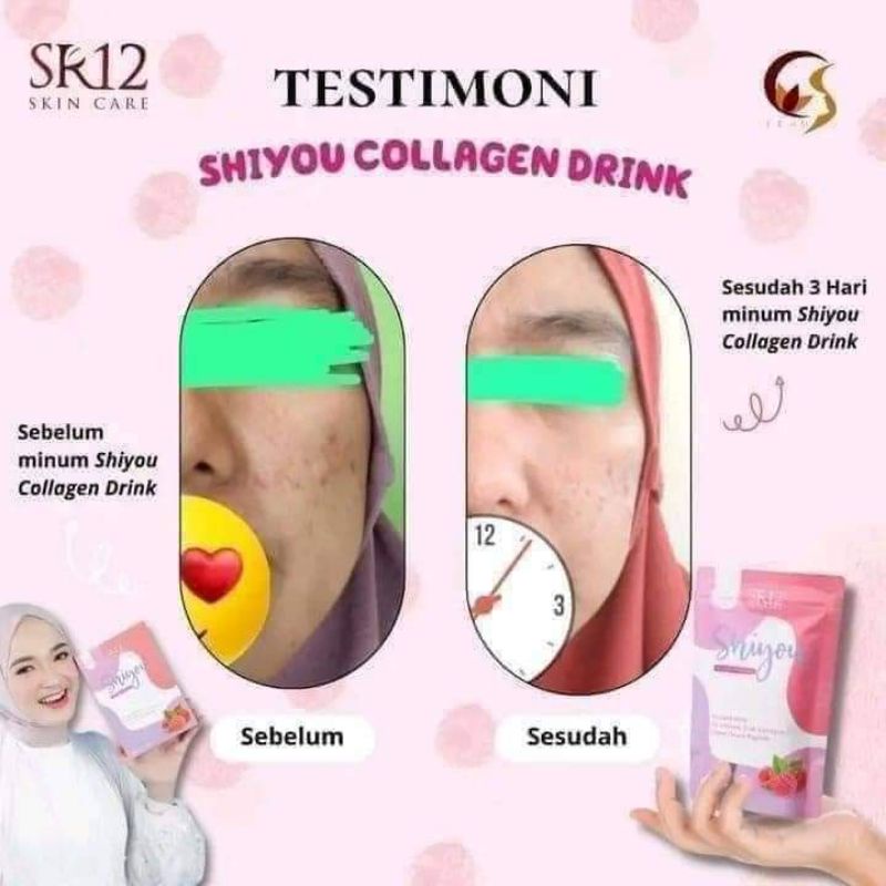 

ShiyouColagenSR12PemutihBadan AmanUntukbusuiDanBUMIL