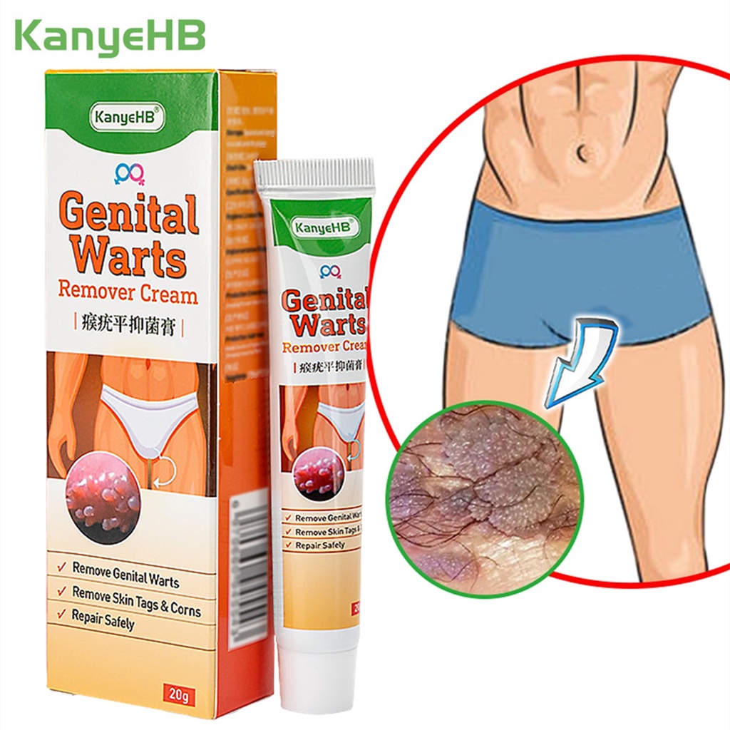 [Privasi Terjaga] Obat Kutil Kelamin Pria dan Wanita Obat Kutil Penghilang Salep Asli Obat Kutil Kelamin HPV Sipilis Gonore Kencing Nanah Raja Singa Kutil Di Anus Gatal Penis Bentol Bintik Merah Ruam Kulit Perih Lecet Herpes - Wart Remover 20g