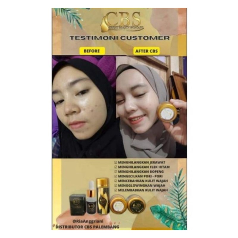 BPOM PAKET CBS CEKFIT BEAUTY SKINCARE UNTUK FLEK DAN JERAWAT SERUM TONER CREAM SABUN