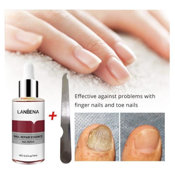 LANBENA NAIL REPAIR PERAWATAN ESSENCE SERUM JAMUR KUKU ESSENCE OIL SERUM NAIL TREATMENT