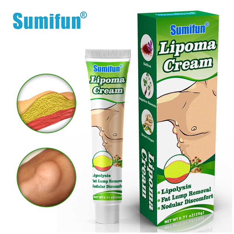 OBAT OLES PENGHILANG BENJOLAN LIPOMA Krim lipoma Obat Benjolan Lipoma 30g Perawatan punggung/leher/paha Kanker Tumor Kelenjar Tiroid Lipoma