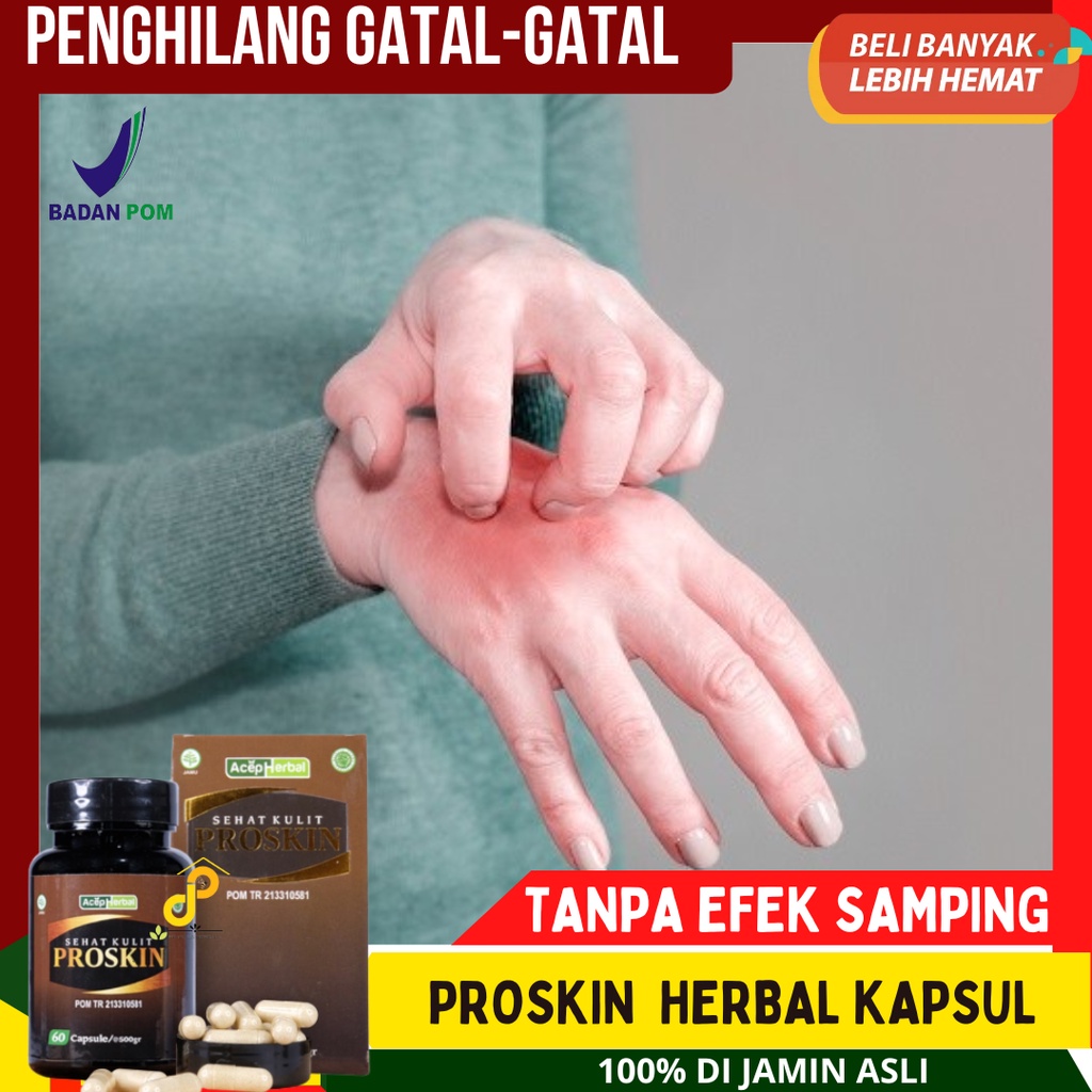 Proskin Obat Gatal Kapsul - Obat Gatal Alergi yang di minum - Obat Gatal-Gatal Seluruh Badan - Mered