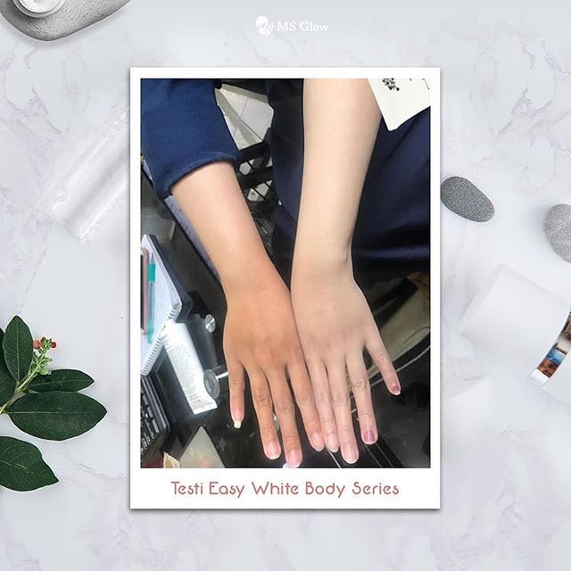 Easy Bright Body Serum Series Ms Glow