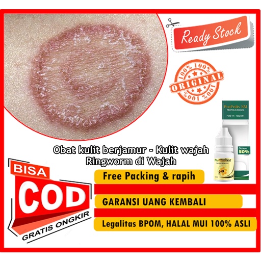 PROPOLIS SM Salep Cair Penghilang Infeksi Jamur Kulit - Obat kulit berjamur - Kulit wajah - Ringworm