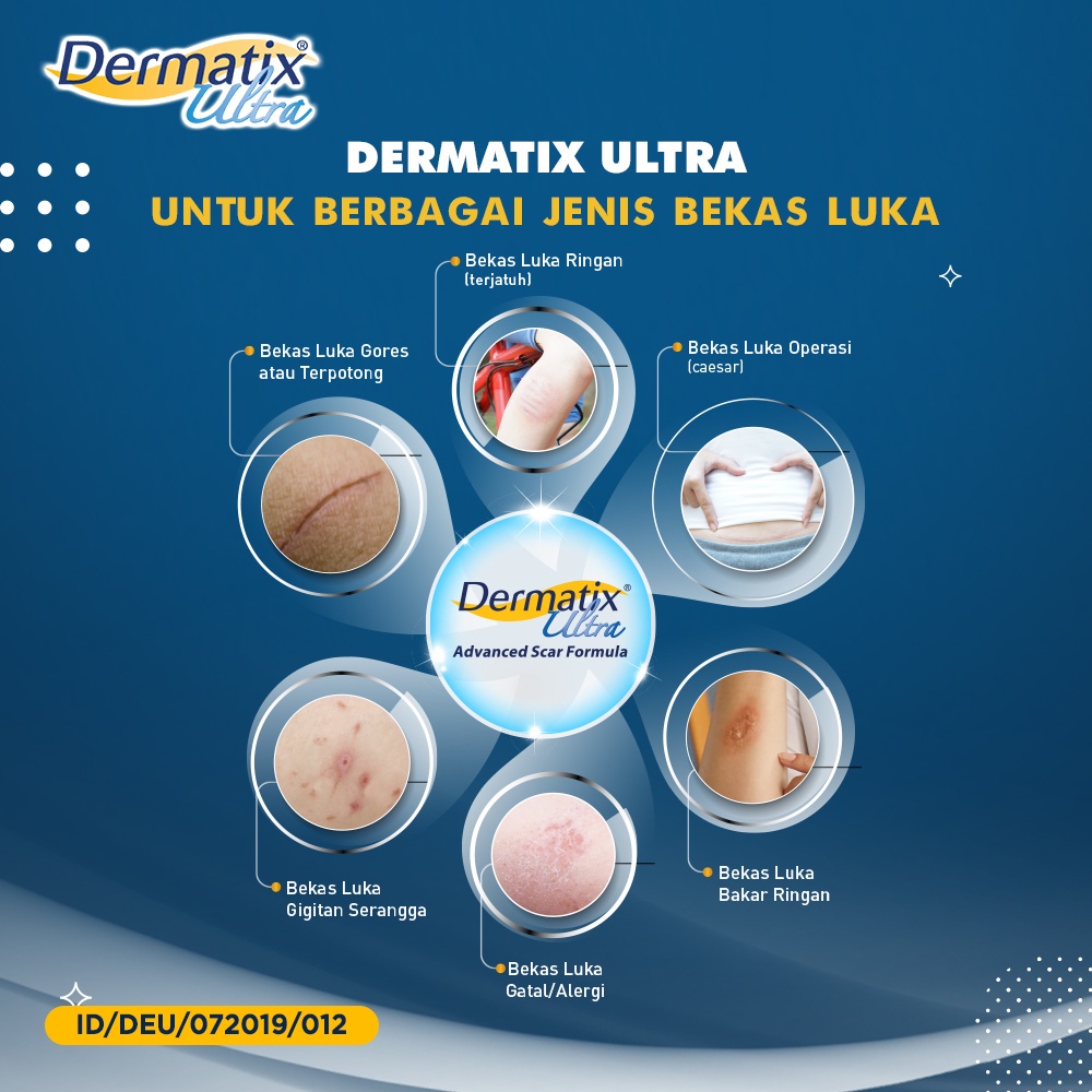 Dermatix Ultra 15g Cream Penghilang Bekas Luka Operasi Jerawat Keloid Advance Gel Acne Spot Care