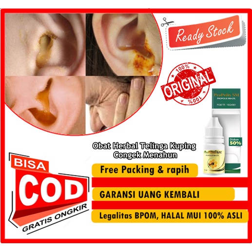PROPOLIS SM - Obat Herbal Telinga Kuping Congek Menahun, obat telinga keluar cairan / berair, obat t