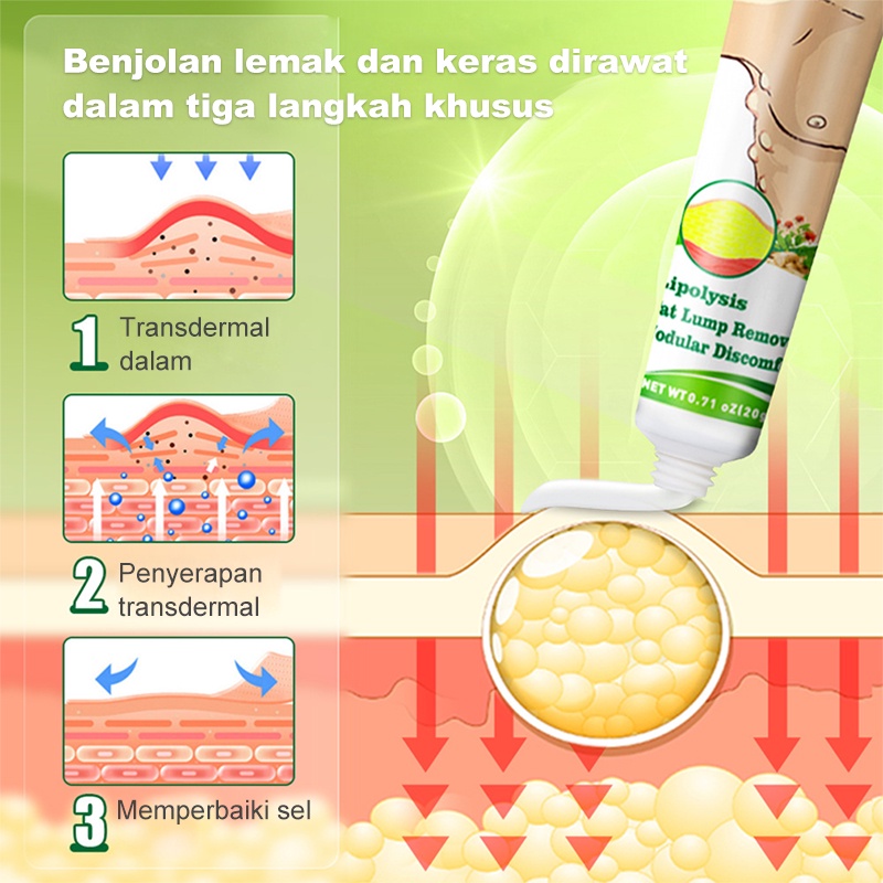 OBAT OLES PENGHILANG BENJOLAN LIPOMA Krim lipoma Obat Benjolan Lipoma 30g Perawatan punggung/leher/paha Kanker Tumor Kelenjar Tiroid Lipoma