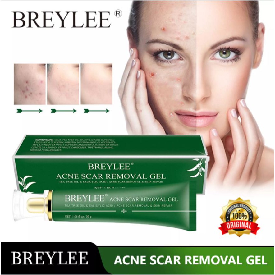 Acne Scar Removal Gel Penghilang Bekas Luka Jerawat Bintik-Bintik