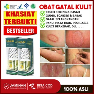 Jual Obat Salep Gatal Kulit Eksim Kering Dan Basah Menahun Gatel ...