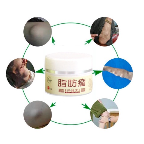【COD】Krim Antitumor 30g Obat benjolan salep benjolan Obat Benjolan lipoma