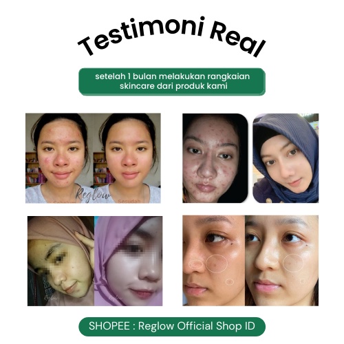 [FREE ONGKIR] REGLOW SERIES Skincare Original Glowing Skin Treatment Perawatan Wajah Glowing Menghilangkan Flek Hitam Membandel Paket Whitening Perawatan Kecantikan Skin Care Reglow dr Shindy Putri Re Glow Beauty Official Store Resmi Ori
