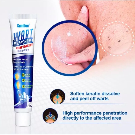 Wart Remover SUMIFUN - Salep Obat Penghilang Tahi Lalat dan Kutil Sumifun