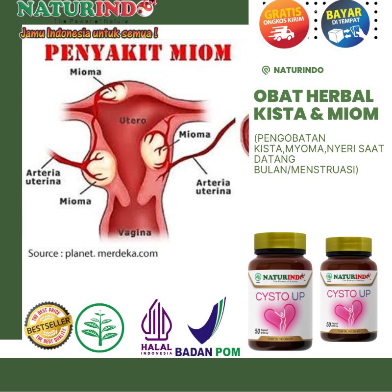 Obat Kista dan Miom Herbal Obat Kista Bartholin Kista Coklat Obat Kista Endometriosis Ampuh CYSTO UP