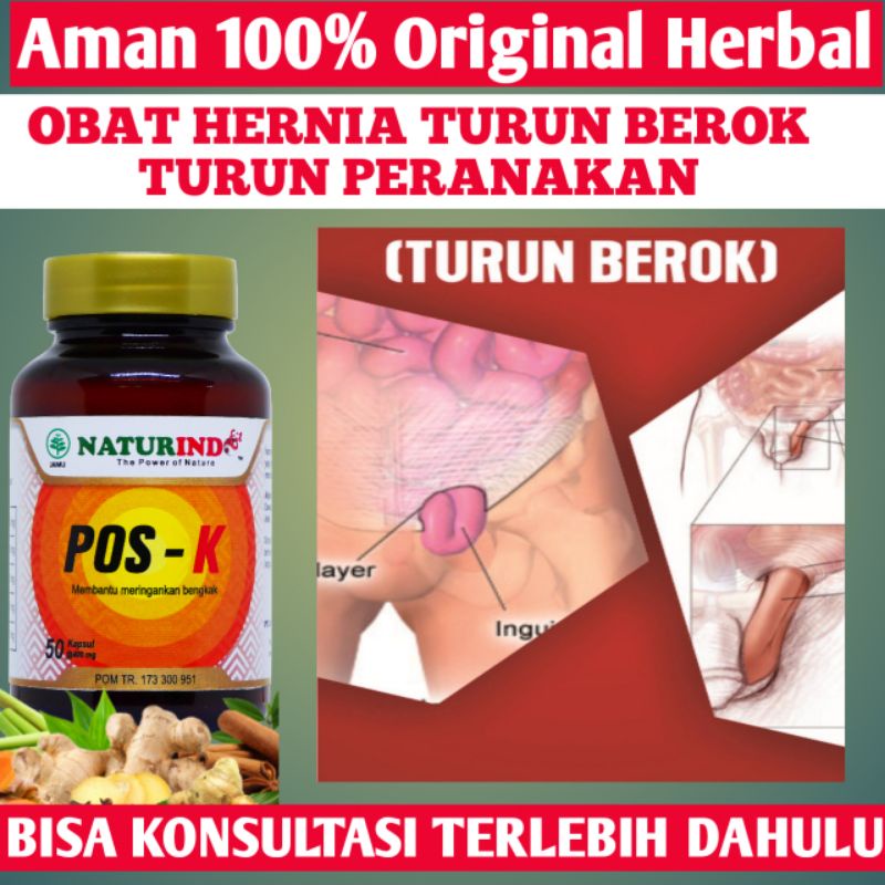 Hernia inguinalis Hernia femoralis Hernia umbilikalis Hernia hiatus Hernia insisional Hernia epigast