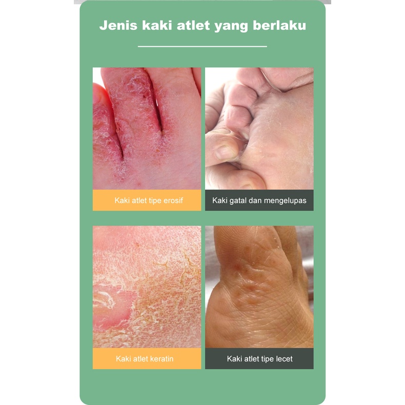 Obat Telapak Kaki Rayapan Kaki Rayapan Kaki Rayap Bau 20g Kaki Bolong Bolong Seperti Kena RayapTumit Kaki Pecah Telapak Kaki Rayapan Penghilang Kaki Rayapan Kaki Bolong Bolong Kaki Bolong Telapak Kaki Bolong, Telapak Kaki Bolong Bolong