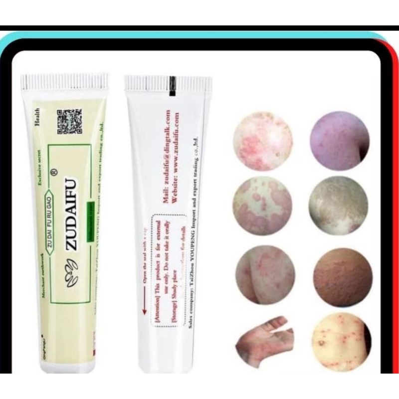 Salep ZUDAIFU (untuk obat gatal ,kurap dll