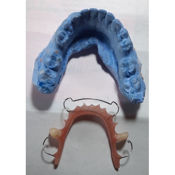 how lay retainer + 2 gigi palsu