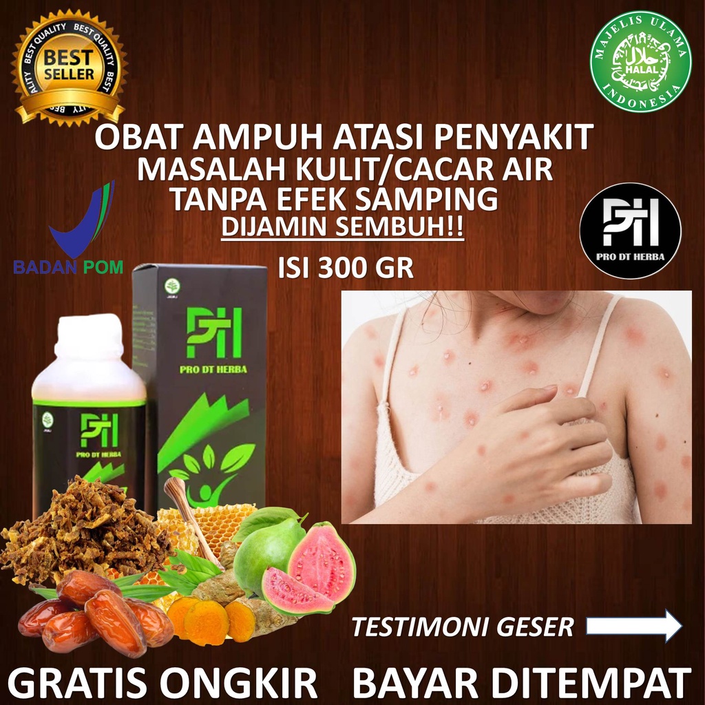 Obat cacar paling ampuh kuman air cacar air anak & dewasa penyakit masalah kulit lainya PRO DT HERBA