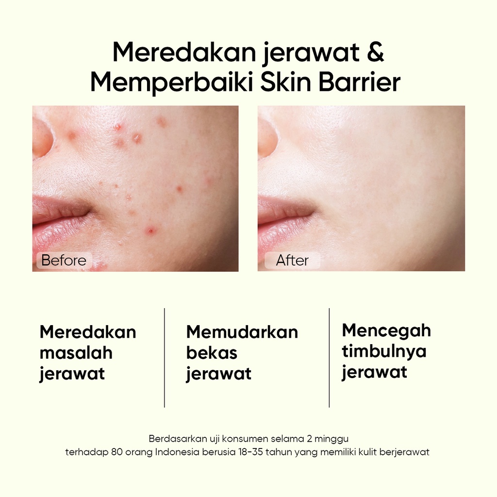 BIG SIZE SKINTIFIC 2% Salicylic Acid Anti Acne Serum 50ml Serum Jerawat Melembabkan wajah Facial Serum