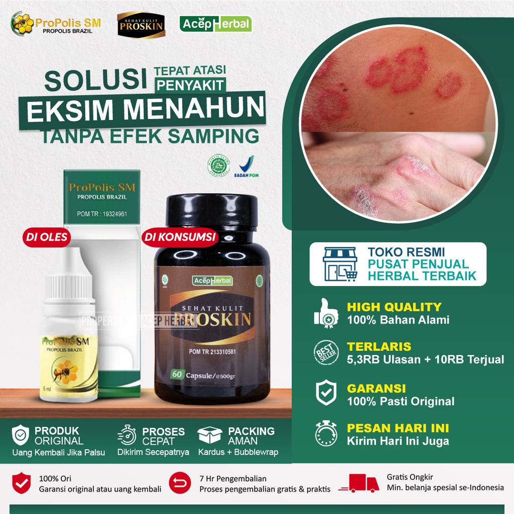 Jual Obat Eksim Basah Kering Menahun Gatal Selangkangan Kurap Kudis Budug Borok Gatal Seluruh