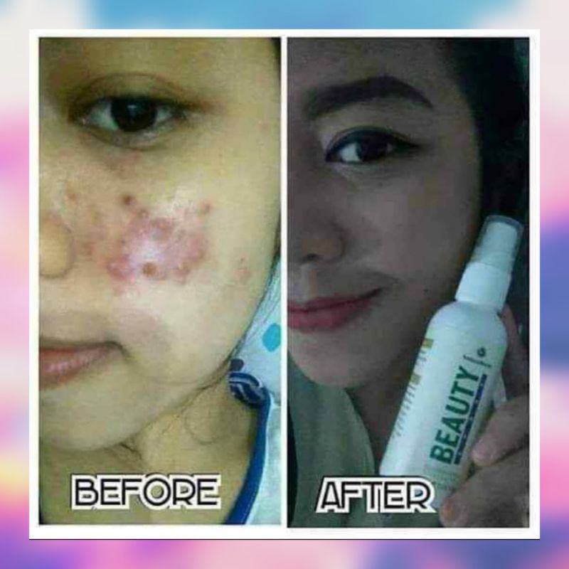 natura beauty spray ORI