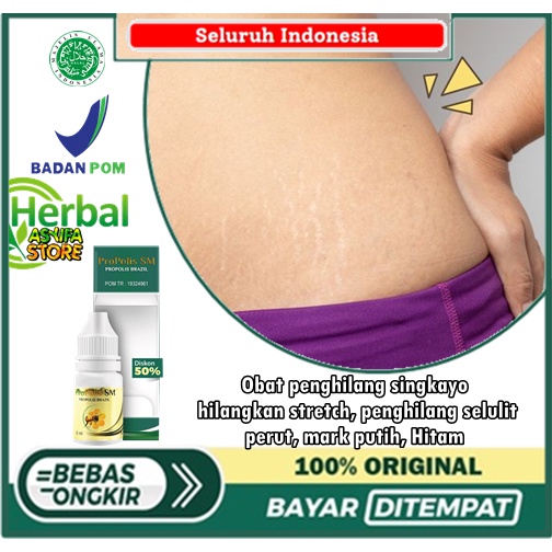 Obat penghilang singkayo, hilangkan stretch, penghilang selulit, perut, mark putih, Hitam - Propolis
