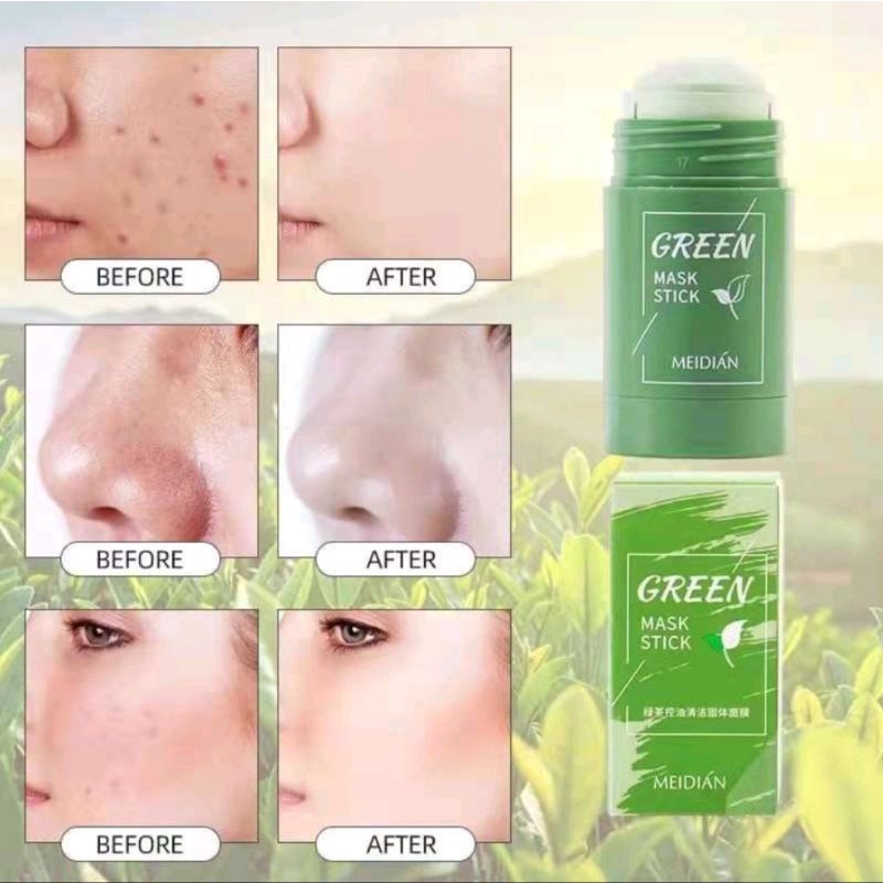 PROMO‼️MASKER WAJAH MUKA GREEN TEA GLOWING JERAWAT BRUNTUSAN BOPENG KOMEDO DAN BEKAS JERAWAT AMPUH S
