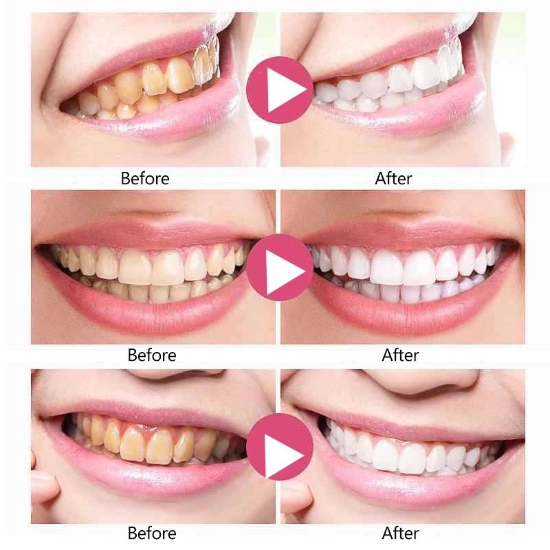 Pasta gigi pemutih gigi Whitening Toothpaste 110gr Antibakteri Gigi Dalam Whitening Power Pasta Gigi Cegah kerusakan gigi anak bisa menggunakan
