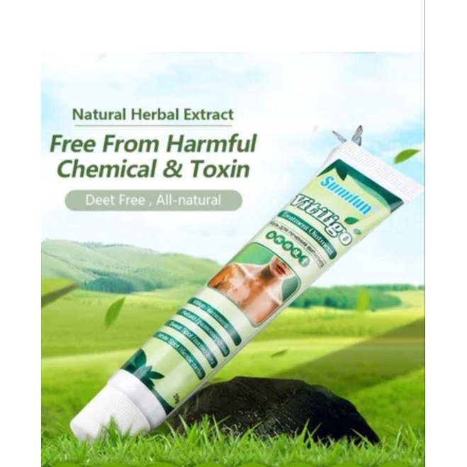 Salep Cream Vitiligo 20 gram Herbal Aman, Salep Cream Belang Herbal Aman, Salep Cream Bercak Herbal Aman