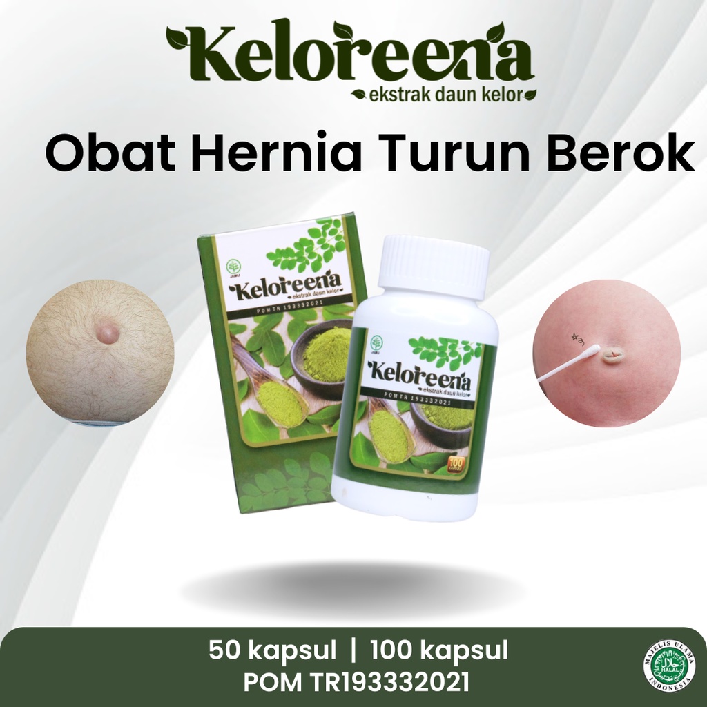 Obat Hernia Turun Berok Usus Peranakan Hernia Inguinalis Femoralis Umbilikus Hiatal Pria Dewasa Wani