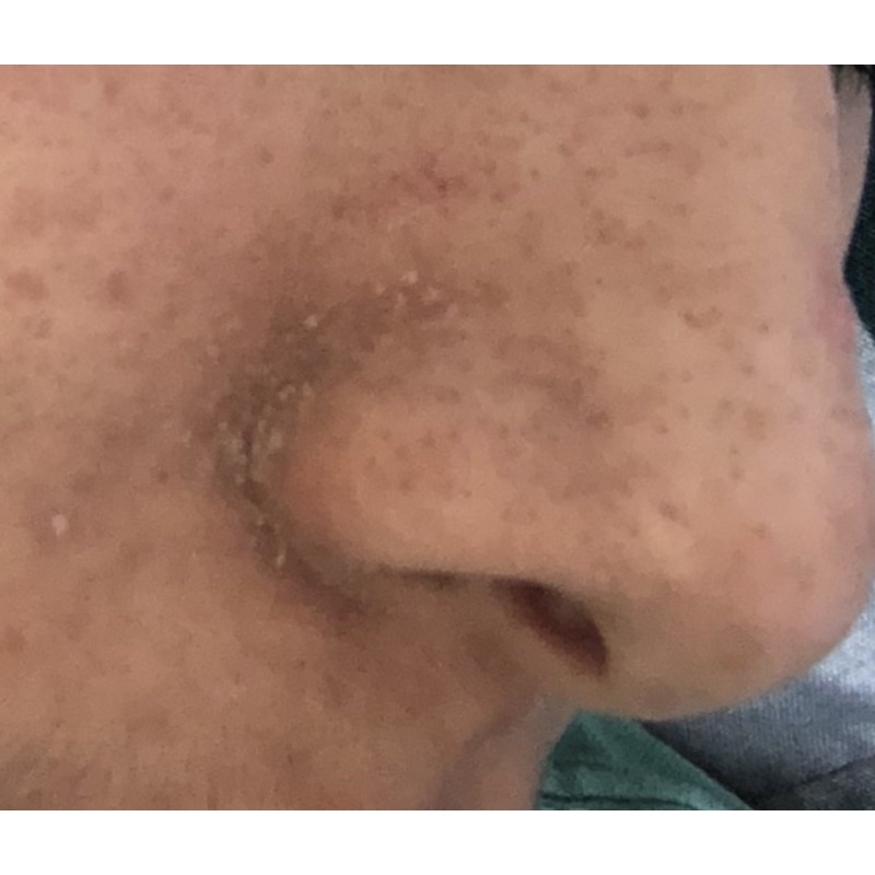 Anti Iritasi Series Aknèlab (1 paket) menyembuhkan iritasi pada kulit wajah