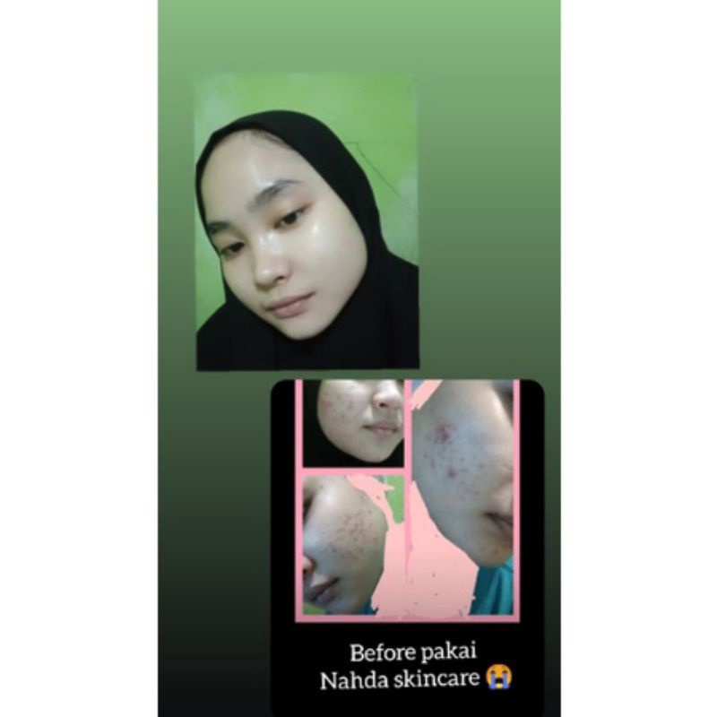 NAHDA SKINCARE PAKET NORMAL ORIGINAL BER BPOM (TERMURAH)