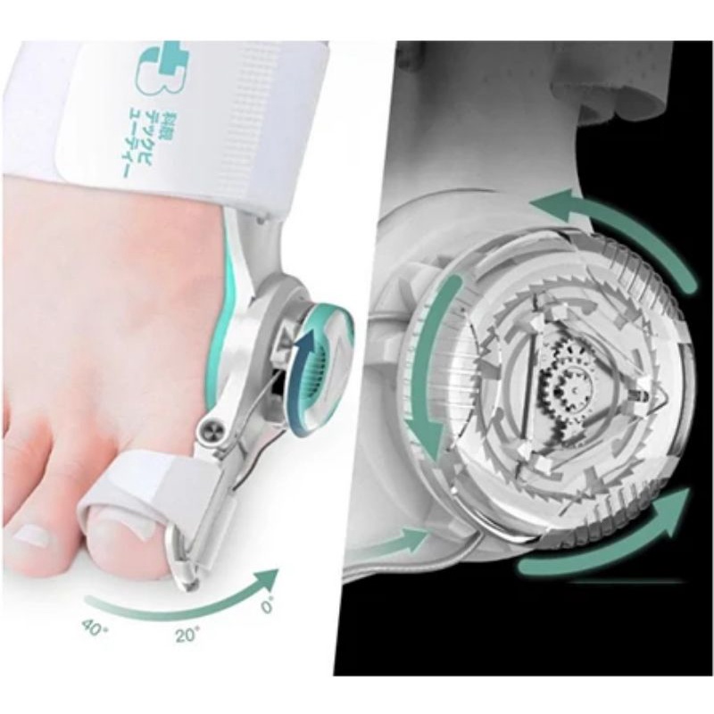 Hallux Valgus Knob Bunion Corrector Bunion Therapy Toe Separator Thumb Splint Braces