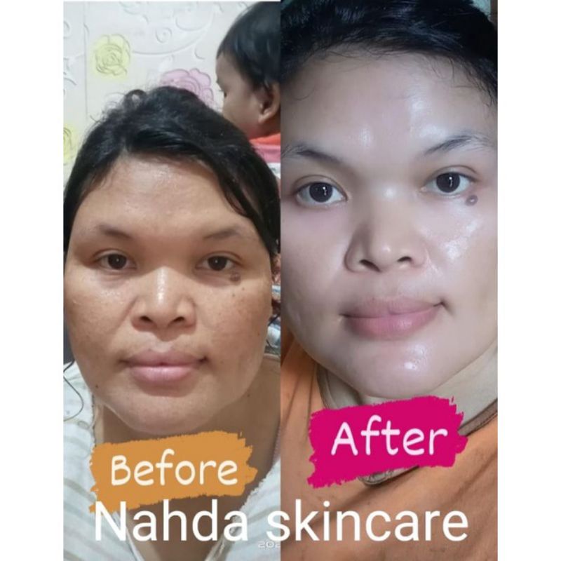 NAHDA SKINCARE PAKET NORMAL ORIGINAL BER BPOM (TERMURAH)