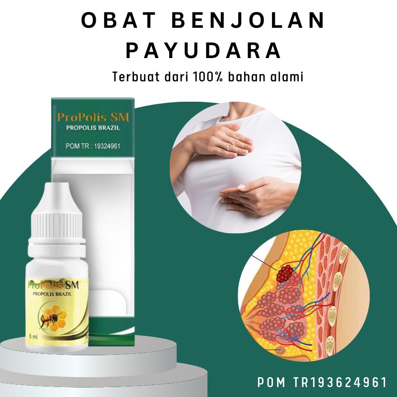 Kaka Herbal - Obat Benjolan Di Payudara, Minyak Oles Benjolan Di Payudara, Obat Herbal Penghancur Be