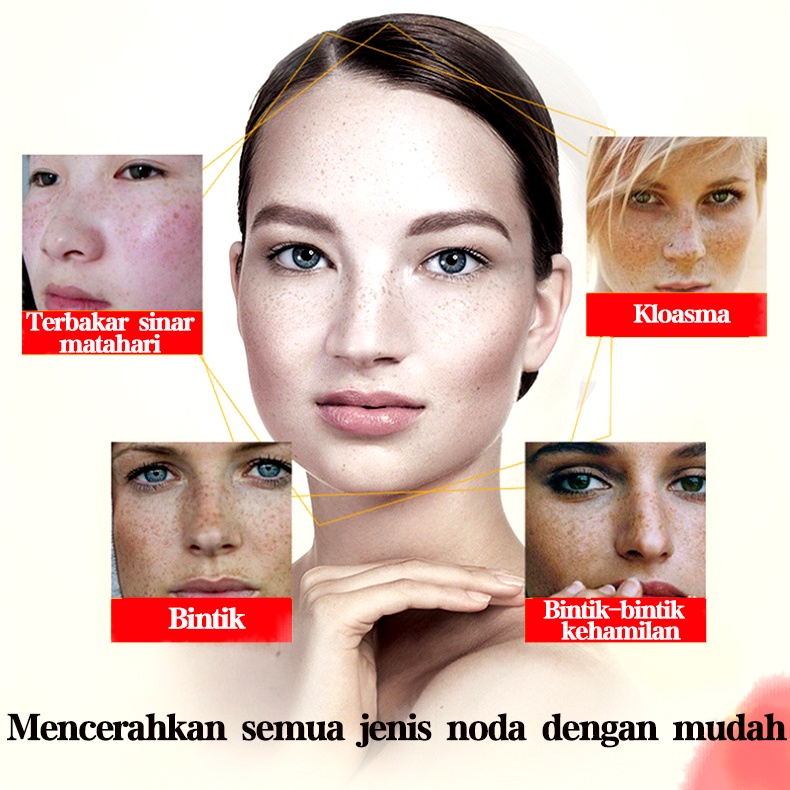 Cream penghilang flek krim pemutih Penghilang flek hitam di wajah hitam  krim penghilang flek  20G menghilangkan flek hitam whitening  freckle cream Moisturizing，Whitening, Dark Spots Remover Brighten Skin Anti-Aging