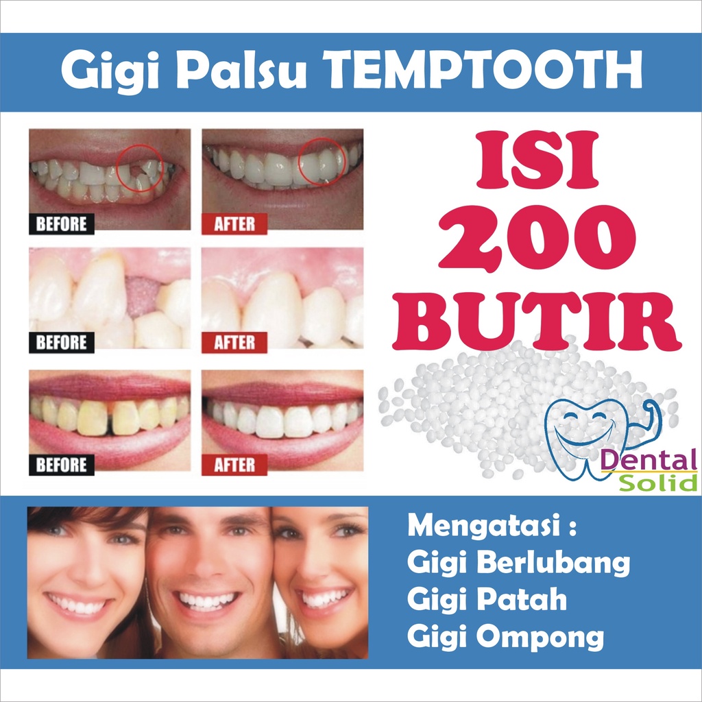 Temptooth Gigi Palsu 200 butir Buat Sendiri Perawatan Kecantikan