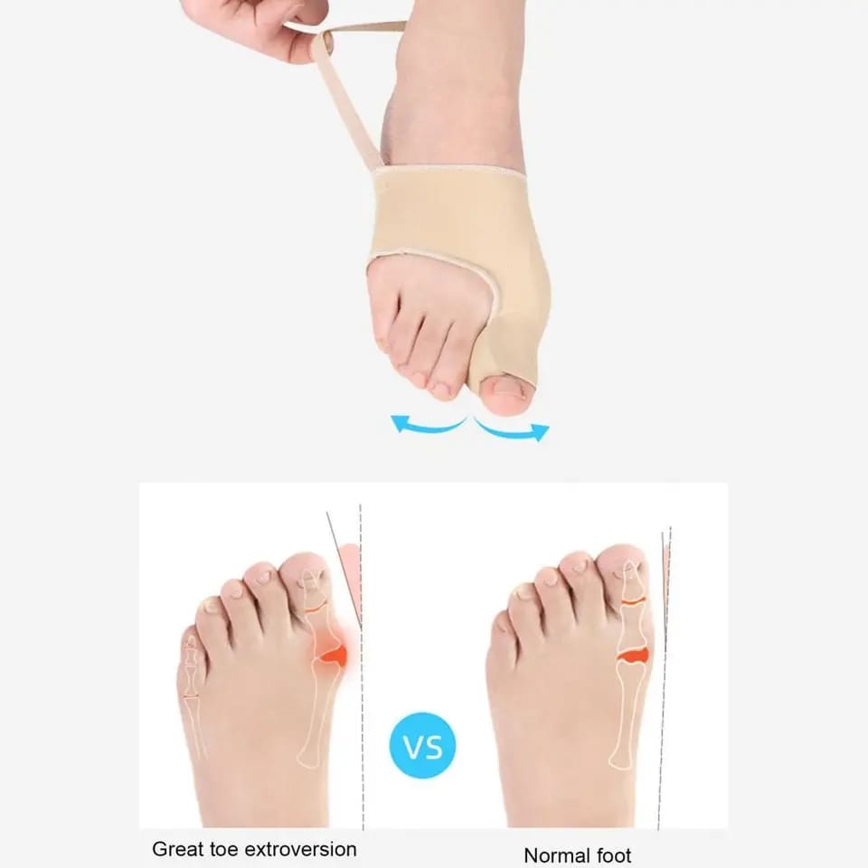 SEPASANG BUNION CORRECTOR INSOLE HALLUX VALGUS BAHAN KAIN DENGAN GEL