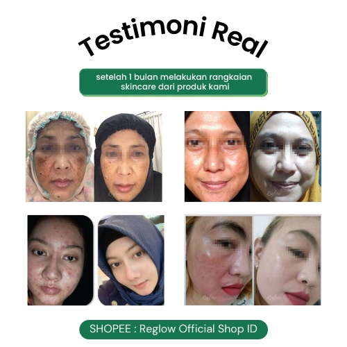[FREE ONGKIR] REGLOW SERIES Skincare Original Glowing Skin Treatment Perawatan Wajah Glowing Menghilangkan Flek Hitam Membandel Paket Whitening Perawatan Kecantikan Skin Care Reglow dr Shindy Putri Re Glow Beauty Official Store Resmi Ori