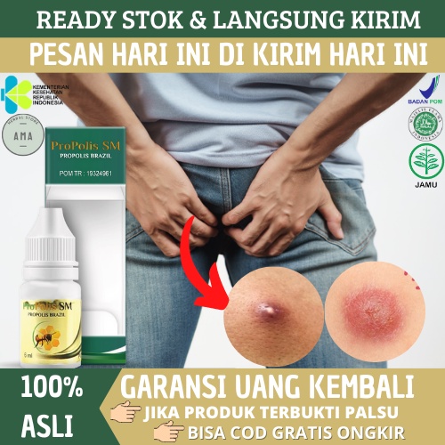 Obat Pengempis Bisul Di Pantat, Obat Bisul Di Pantat, Obat Bisulan Di Pantat, Obat Pantat Bisulan, O