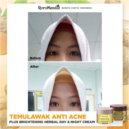 * NCC * Roro Mendut Paket Starter Temulawak Day Cream Night Cream Soap Bar Skincare Skin Care