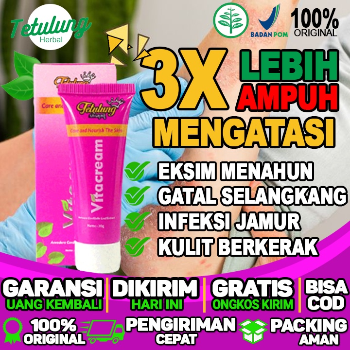 Obat Salep Pembasmi Jamur Kulit Dan Eksim Menahun Di Kaki