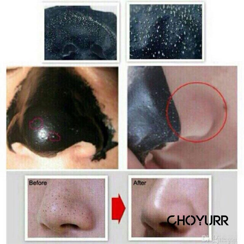 【COD】Charcoal Anti Blackhead / Peeler Blackhead / Masker Komedo / Blackhead Care Mask / Pembersih Komedo/ Ampuh Penyedot Comedo / Penghilang Komedo -CH