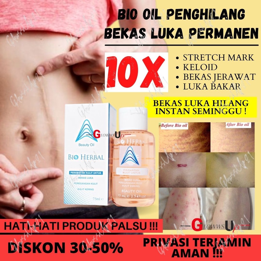 BIO OIL STRETCH MARK PENGHILANG BEKAS LUKA BIO HERBAL BEAUTY OIL 75ML