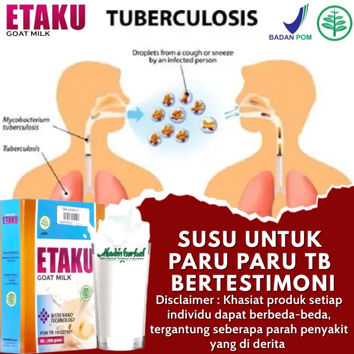 

Susu Untuk Paru Paru TB 100% BERTESTIMONI - Susu Untuk Penderita Asma - Infeksi Paru Paru - Nyeri Dada Dan Sesak Napas - Susu Untuk Bersihkan Paru-paru - Susu Bisa Bersihkan Paru Paru - Susu Sehat Paru - Susu Buat Paru Paru Dengan Etaku Goat Milk Original